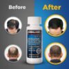 Minoxidil kirkland 5% USA