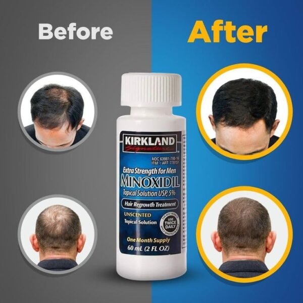 Minoxidil kirkland 5% USA