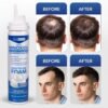Minoxidil 5% (Mousse)pour Homme HAIR REGEN