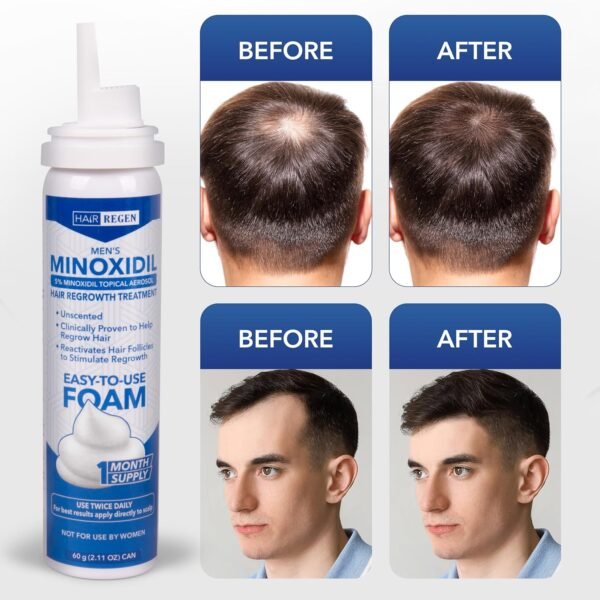 Minoxidil 5% (Mousse)pour Homme HAIR REGEN